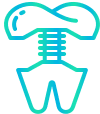 dental implant